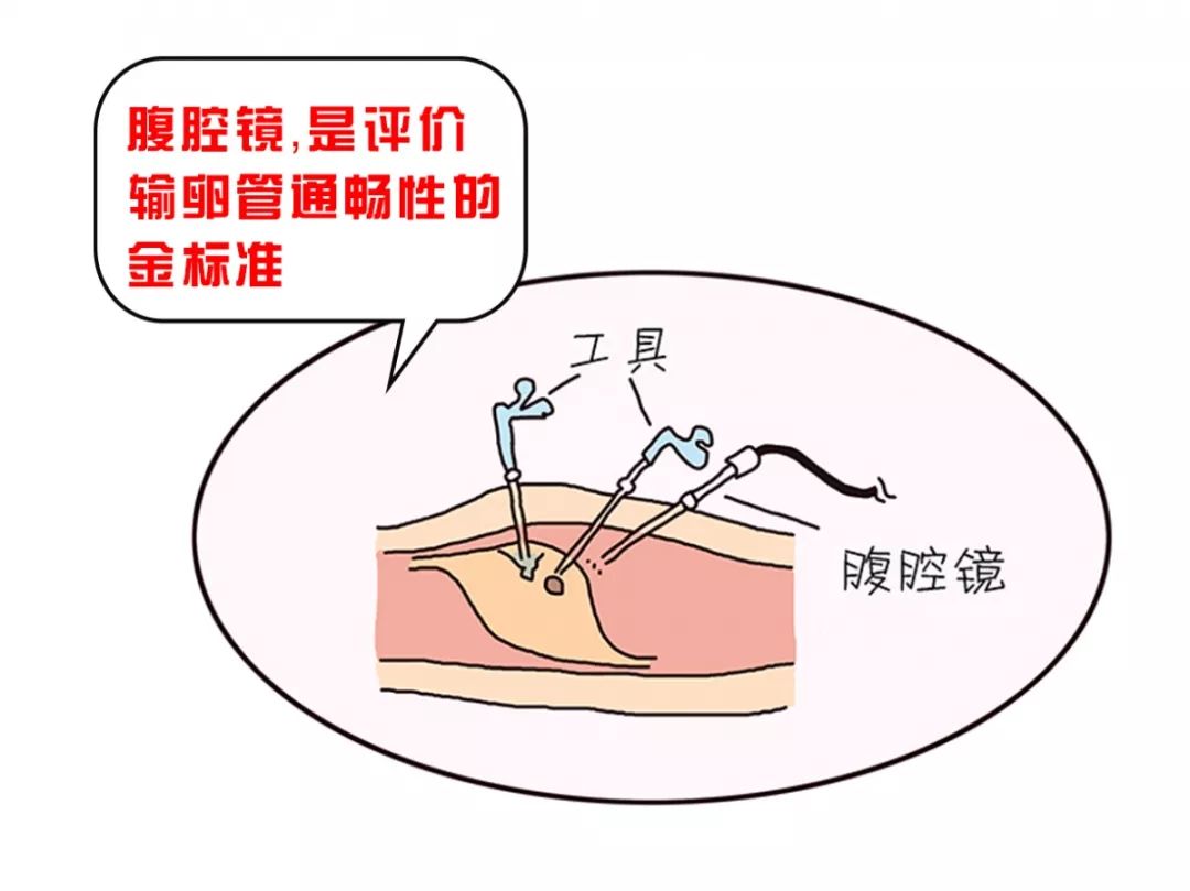 孕早期输卵管积水有影响吗,宝宝迟迟还不来怎么办