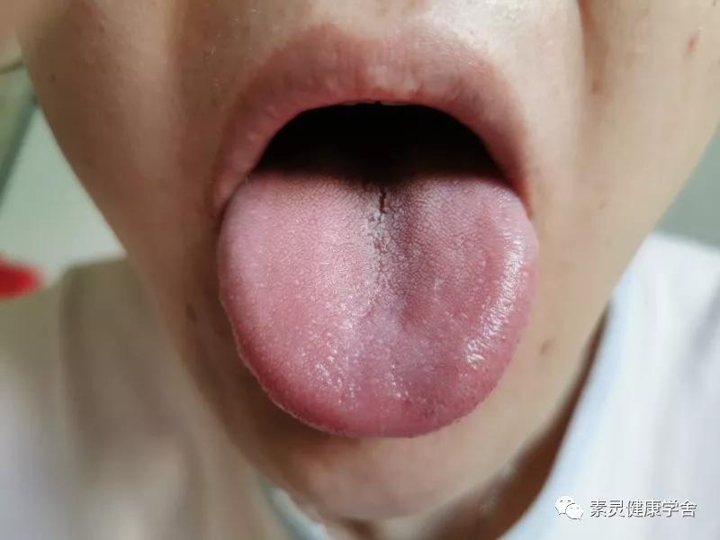 肝功异常的针灸穴位,脐疗绝密配方肝病