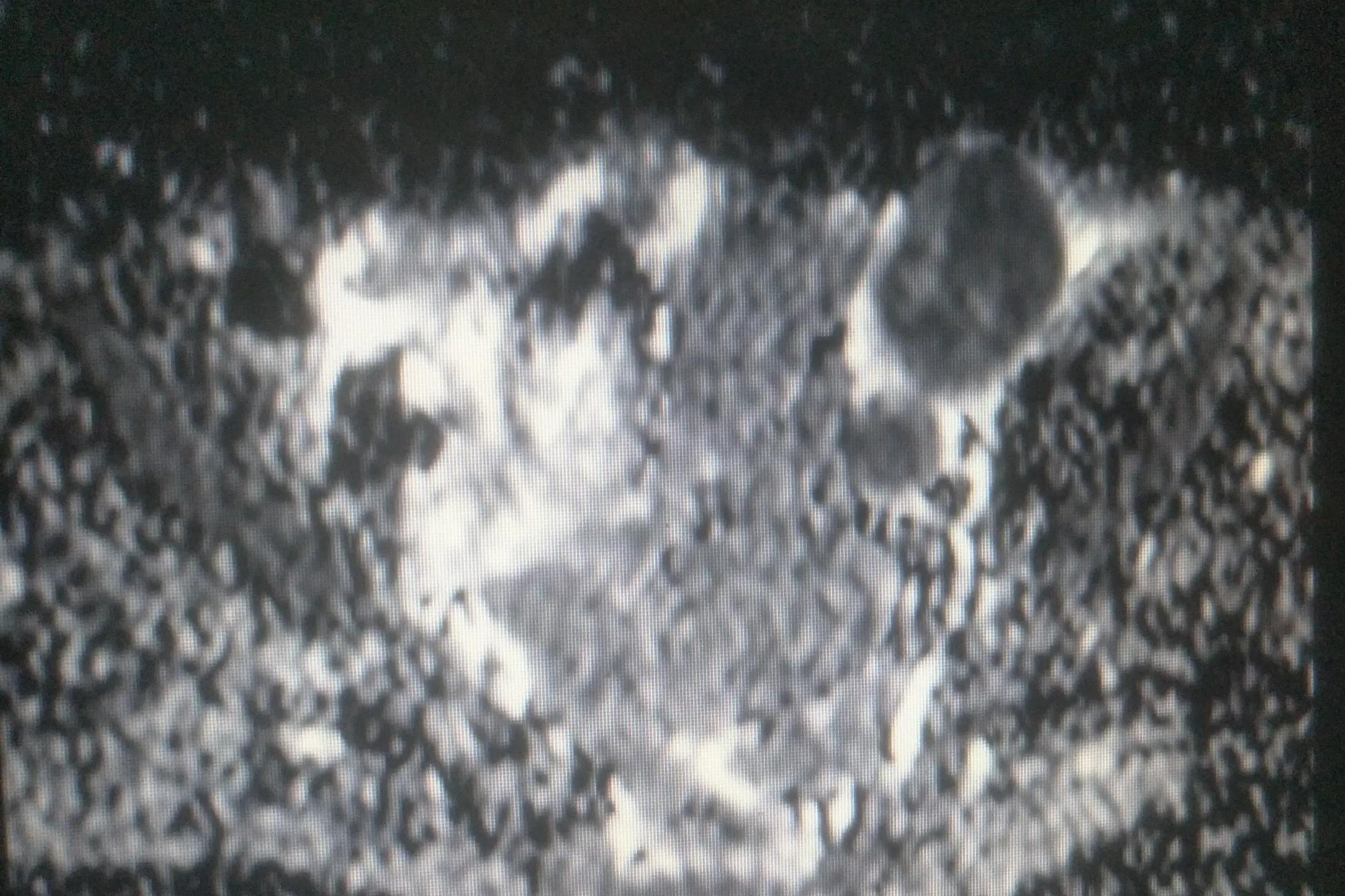 29岁的抗癌之路,26岁胃癌晚期死亡