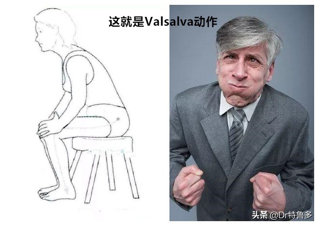 儿童功能性便秘的解决方法,儿童功能性便秘怎么治