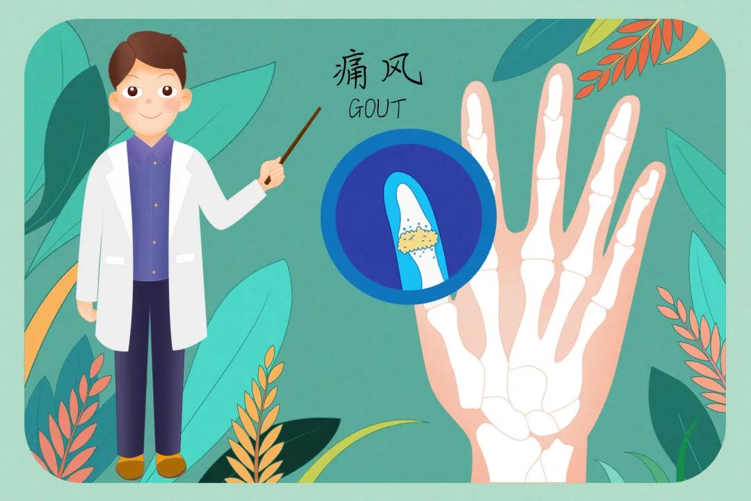 服用帝人痛风药期间痛风发作,痛风三味药根除痛风秘方