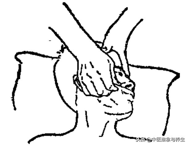 肋间神经痛如何推拿,肋间神经痛的推拿疗法