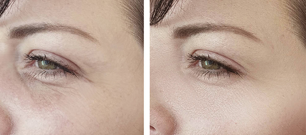 能放进包包的“美容院”，随时淡纹护眼，素颜美女少不了它