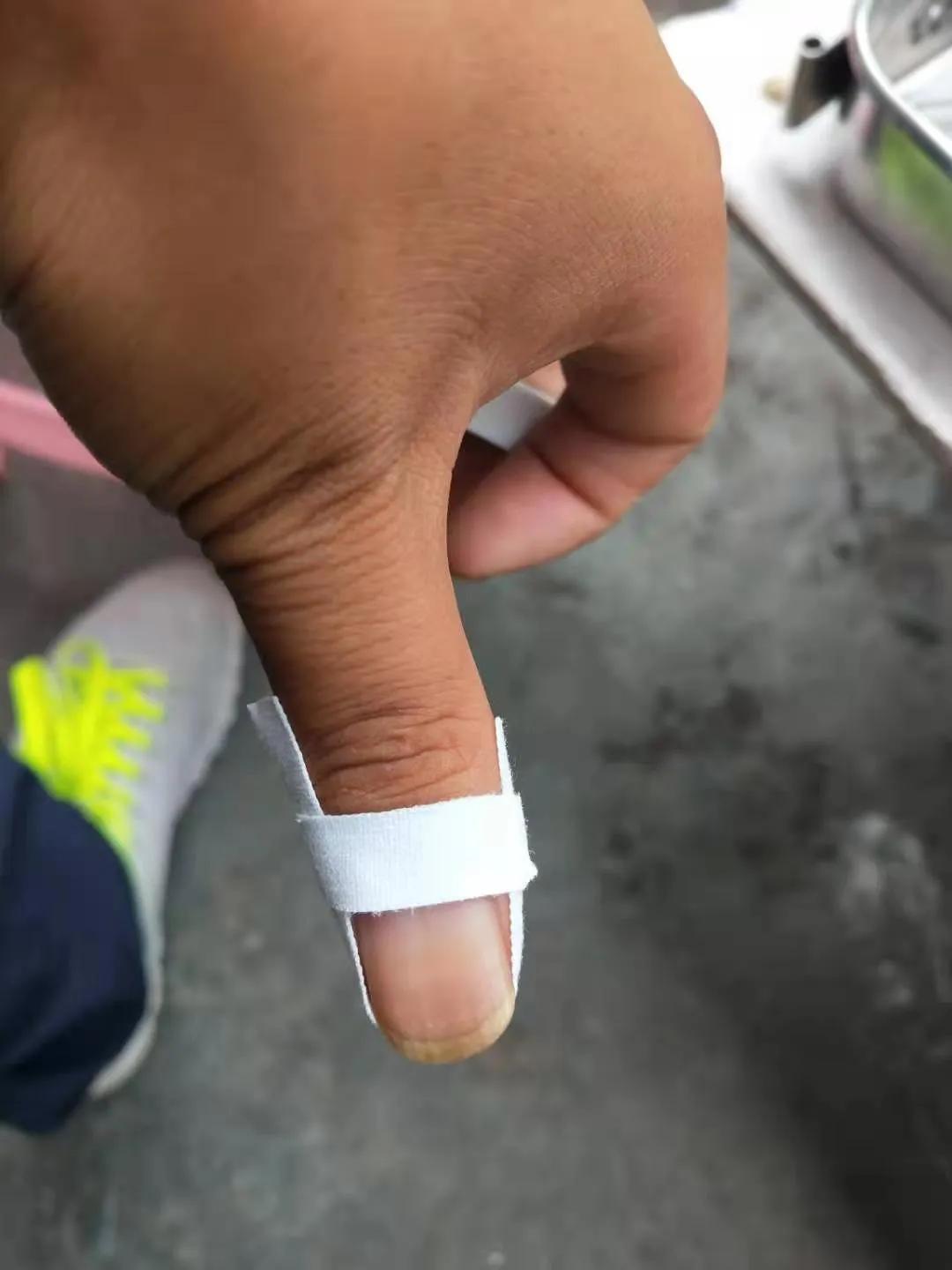 专业修灰指甲,专治鸡眼脚气灰指甲