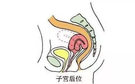 子宫位置前位怎么容易受孕,弓形子宫怀孕的几率是多少