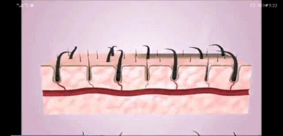 有了这个神器,英国人的脱发有救了?