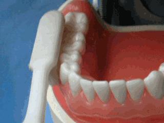 牙齿缺失后不镶牙有啥危害,牙齿缺失后不补有什么危害