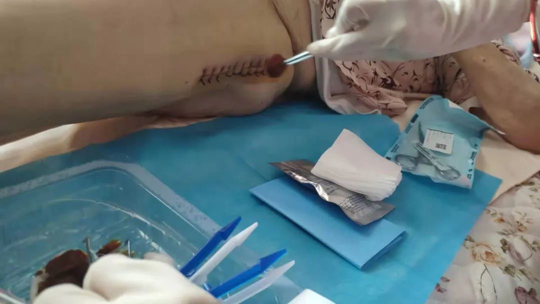 护理|医网情深护暖患心:云上相约为患解忧