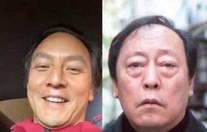 奶茶店天天戴帽子会导致脱发吗,长期戴帽子导致脱发算不算工伤