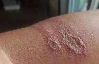 隐形虫出没地方,虫出没名场面