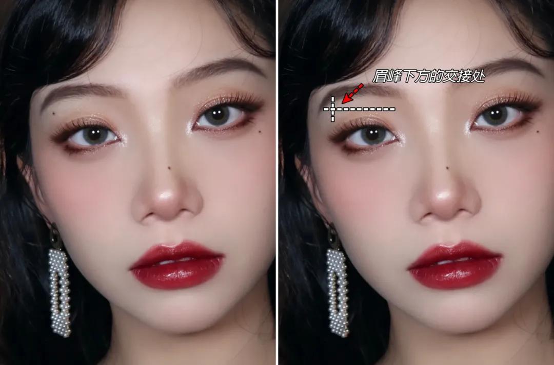 全脸点痣变美,点痣能变美吗