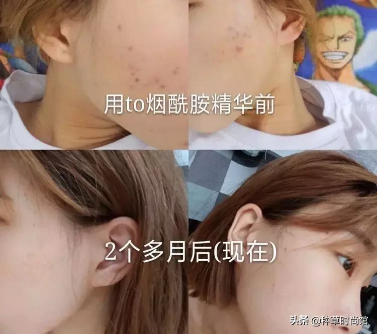 脸色暗黄干皮怎么变白最快方法,暗黄皮用什么护肤品变白