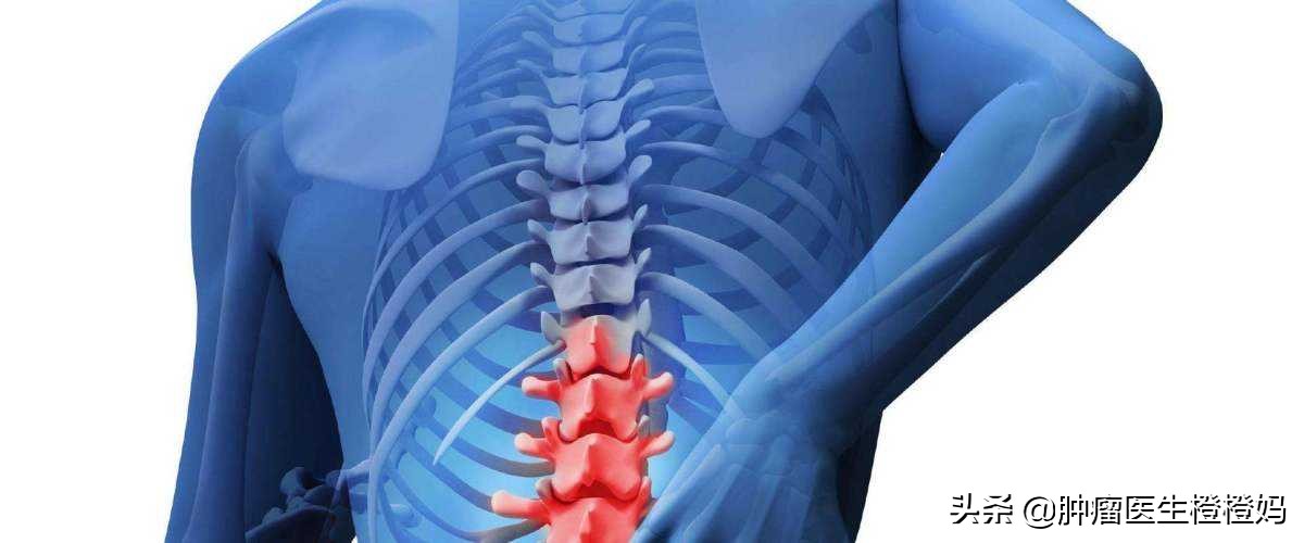 癌症骨转移可以把骨头拿掉吗,骨转移就是癌症晚期吗