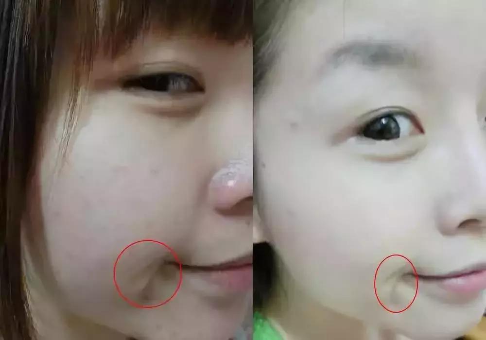 美白大创精华,大创美白精华