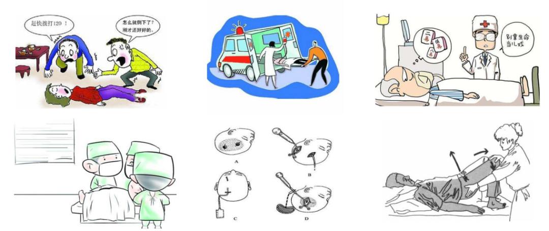 脑出血是开颅好还是引流好,脑出血是手术好还是保守治疗好