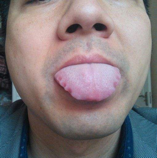 黄芪日常保健怎么服用,补药黄芪什么效果