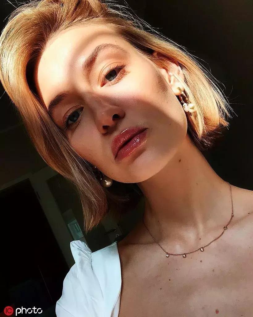 女子挤痘痘颅内感染住进icu,女子挤痘痘引发感染被送急诊