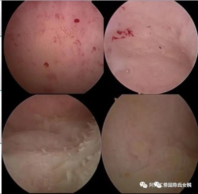 哪些妇科病会引起出血呢,排卵期出血是妇科病吗