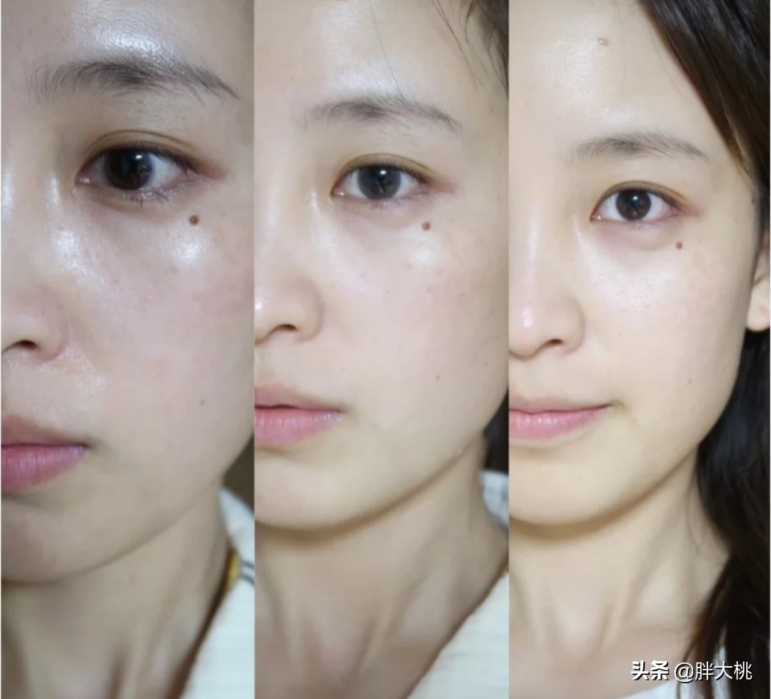 用了烟酰胺皮肤变黄是正常的吗,用烟酰胺变白了还会黑吗