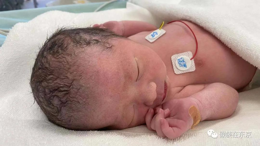 日本人生孩子顺产与剖腹产,疫情期间生宝宝的感受