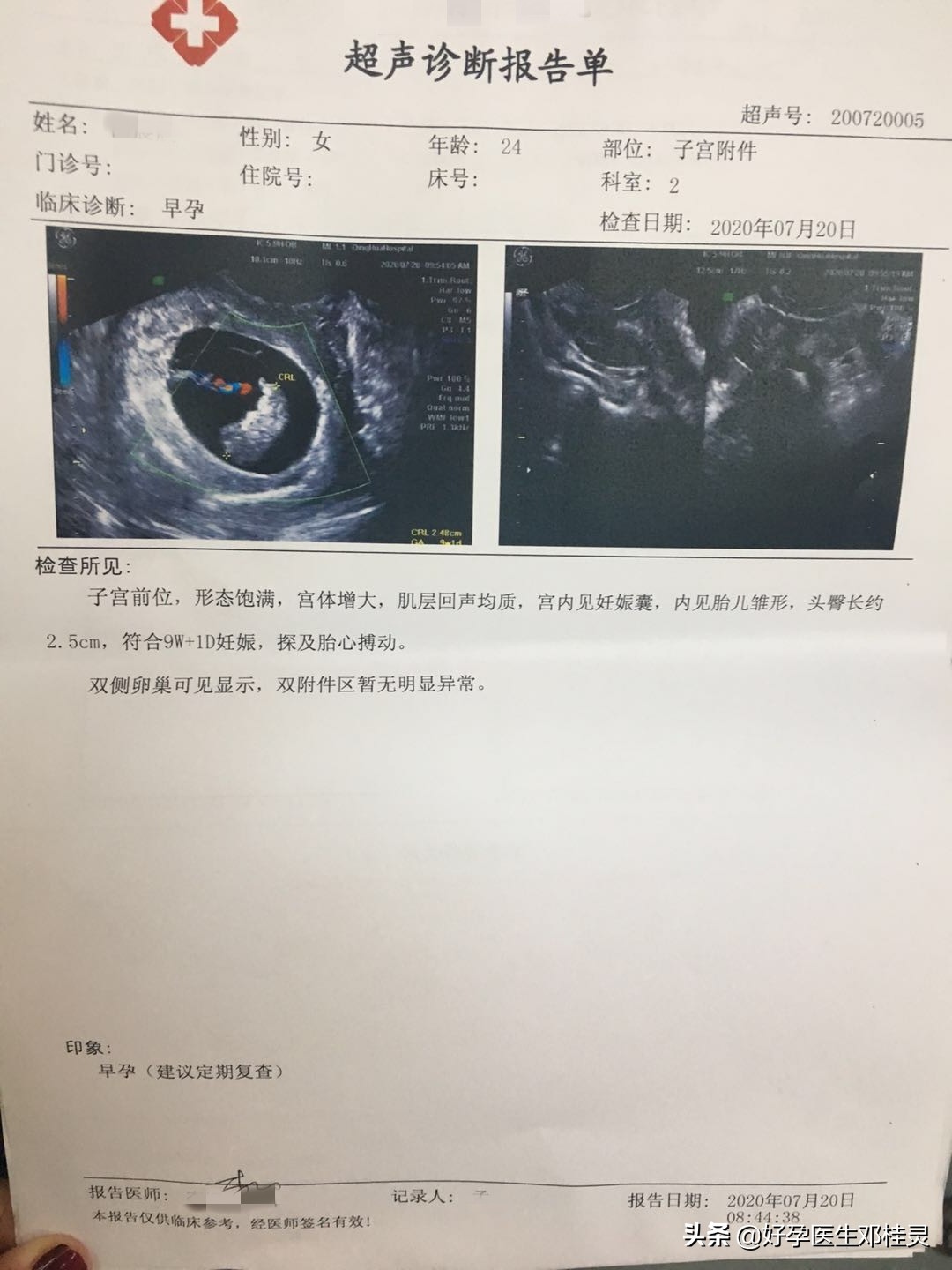 隔了五年备孕二胎不孕,38岁备孕二胎已好孕