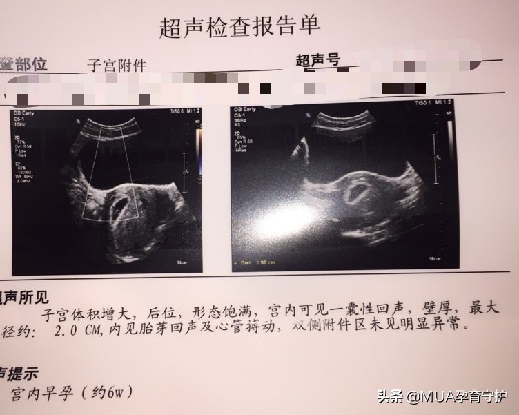 如何确认自己怀孕了,如何确认怀孕了