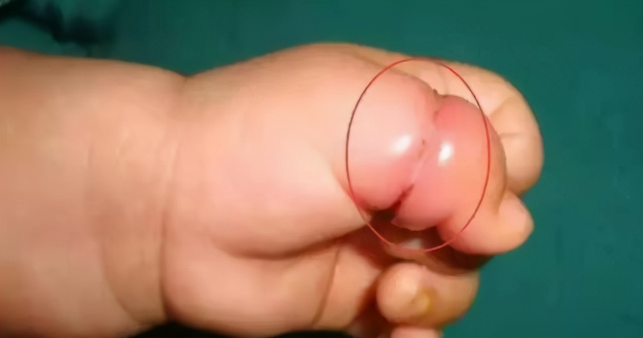 宝宝晚上睡觉抓脸挠头怎么回事,2月龄宝宝睡觉老是挠头挠脸