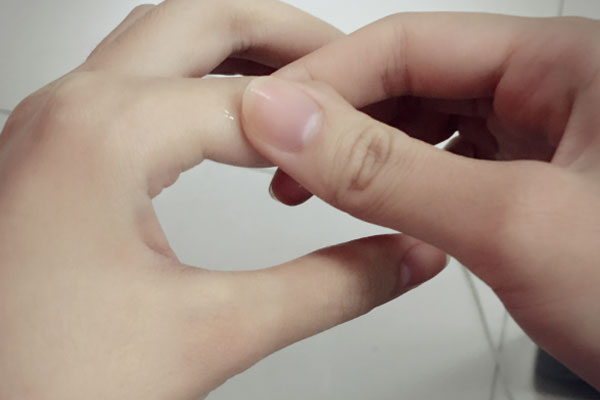 手指脱皮是怎么回事会传染吗,手指脱皮是怎么回事中医