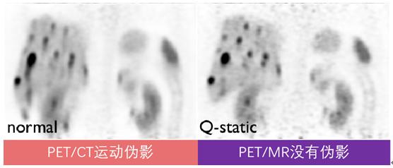 哈医大一院磁共振有片吗,哈医大一院能做内耳磁共振吗