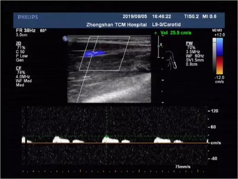 肩臂痛怎么治疗,肩臂痛什么原因