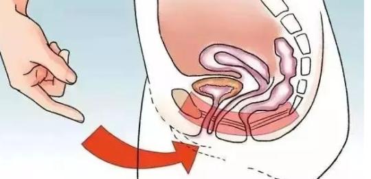 做凯格尔运动有什么用,凯格尔运动的正确做法及整套视频