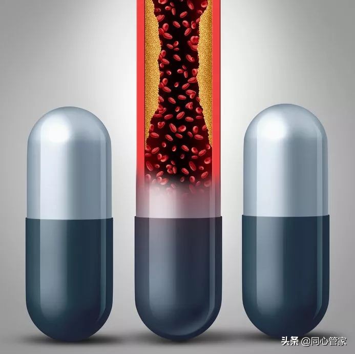 血管狭窄如何扼住生命的咽喉?让你全身器官都遭殃