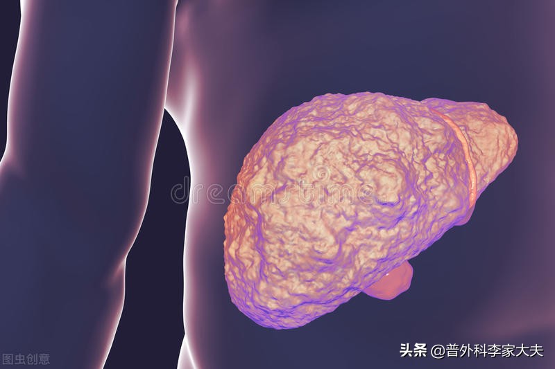 网友弟弟16岁查出肝硬化,医生有失职吗?