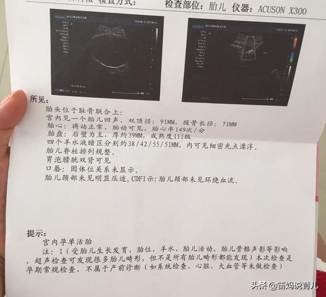胎儿最怕羊水吗,胎儿最怕妈妈哪种表现