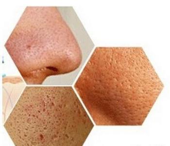 毛孔粗大显老,告别毛孔粗大肤色暗黄