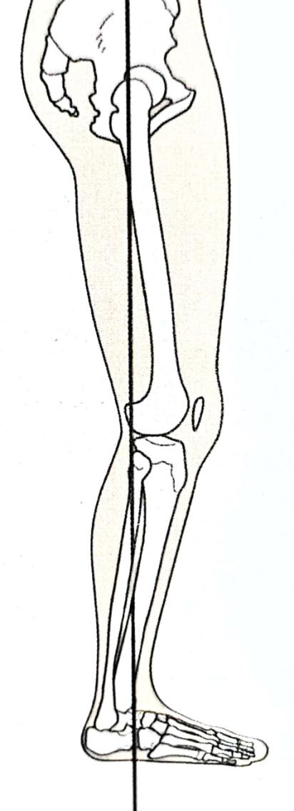 久坐后膝盖窝发软没力了怎么办,久坐膝盖无力站不起来