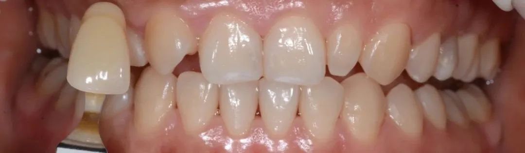 牙医从业感悟,牙医忠告11条