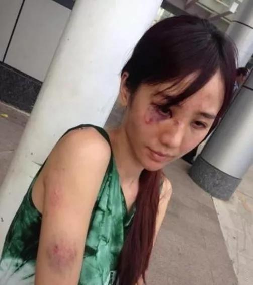 女记者被家暴成“另一个拉姆”,值得同情吗?要远离这几种男人