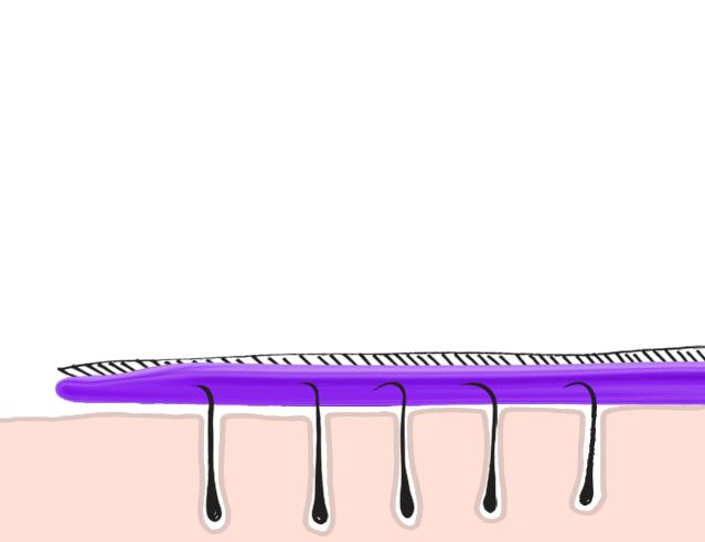 脱毛最好的自然方式,脱毛最好的最安全的办法