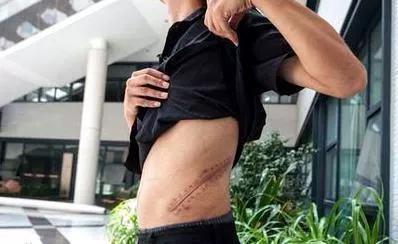 2012用肾换苹果手机的小伙 (当年用肾换苹果手机的人怎样了)