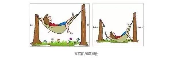 生完孩子尴尬的问题,生完三胎后的尴尬