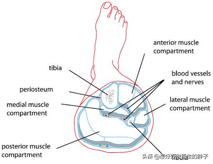 小腿腓骨骨折保守治疗多久能走路,小腿骨折保守治疗多久能恢复正常