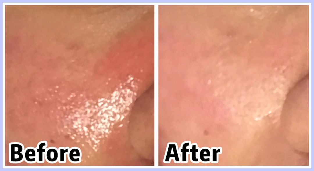 如果被祛痘机构坑了怎么办,我被私立医院骗了怎么办