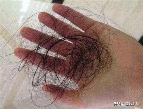 产后腹直肌分离的解决方法,产后腹直肌分离怎么处理