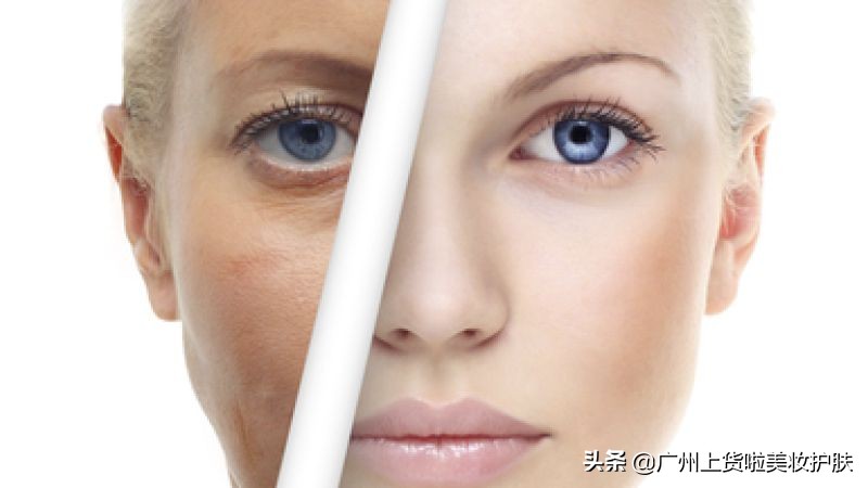 美容微针与滚针的区别在哪,最新技术的微针