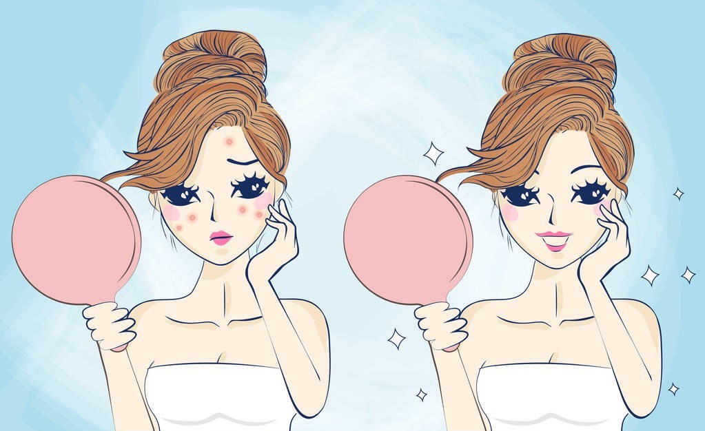 玫瑰*疮痤**患者机体免疫调节的异常，该病发病率呈现逐年上升的趋势