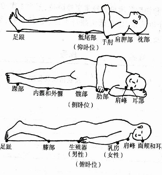 鍋忕槴鎬庢牱棰勯槻瑜ョ柈,灞佽偂鎬庝箞棰勯槻瑜ョ柈