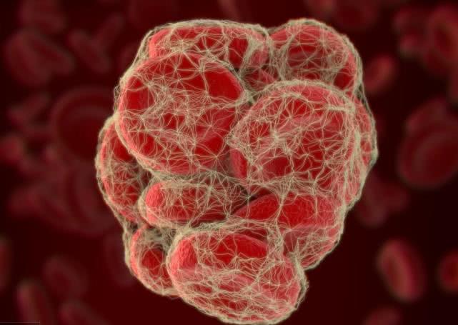 无缘无故的脚肿了怎么回事,女人35岁无缘无故脚肿了怎么回事