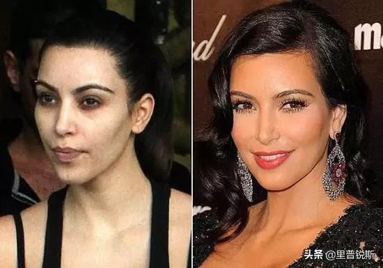 祖传药膏去除眼袋,祖传治疗眼袋