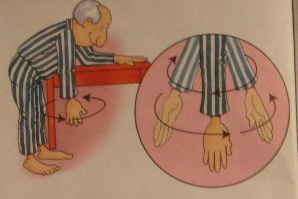 肩周炎自愈辟谣,肩膀疼怎么会引起肩周炎